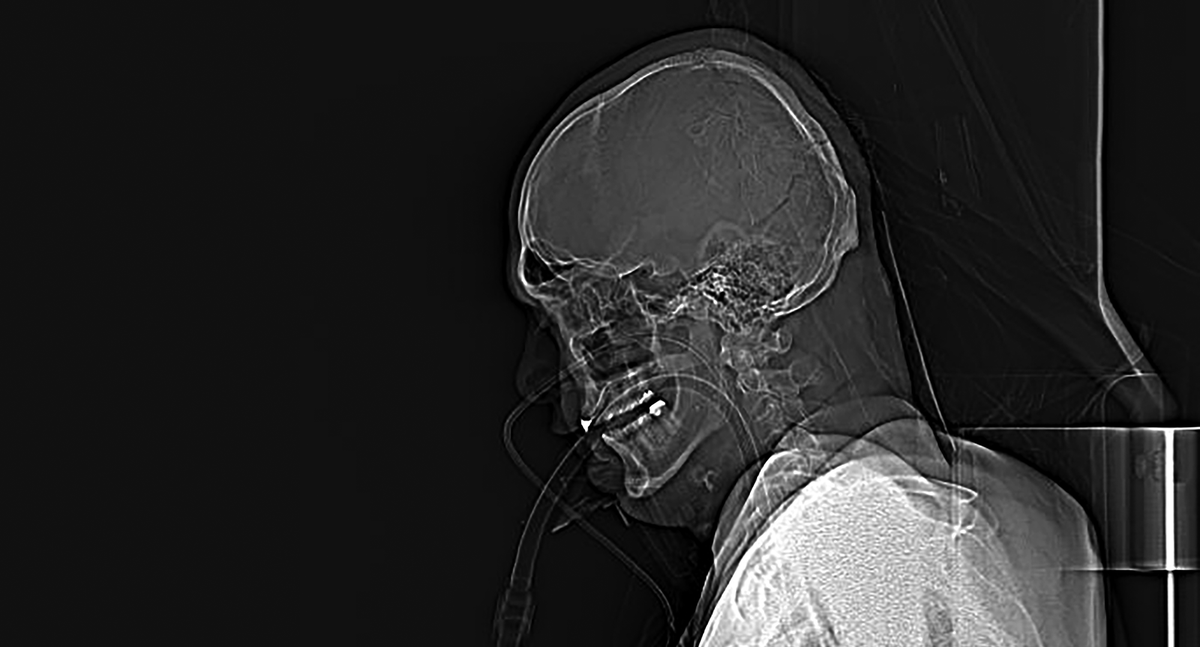 667Run's tweet image. In der Offenbarung des Johannes findet sich erstmals die Zahl 666: »Hier braucht man Kenntnis. Wer Verstand hat, berechne den Zahlenwert des Tieres.…

Den ganzen Beitrag gibt es unter:
667.run/warum-667/