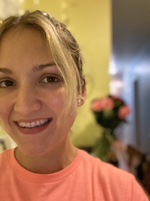 How do I look with my braces ? 🤔😁 https://t.co/88fogKqUPt<a href="/tag/followme"class="tags"><span>#followme</span></a><a href="/tag/everywhere"class="tags"><span>#everywhere</span></a>