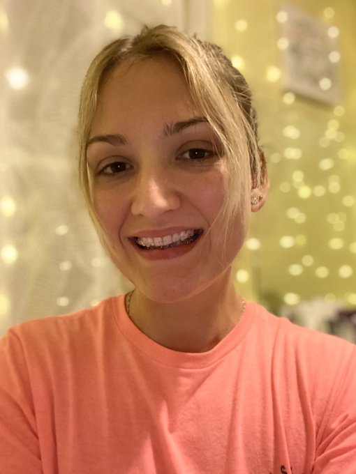 How do I look with my braces ? 🤔😁 https://t.co/88fogKqUPt