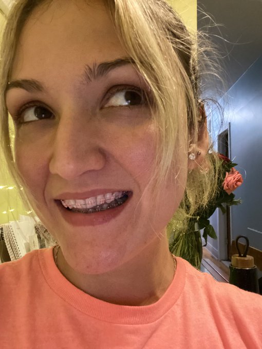 How do I look with my braces ? 🤔😁 https://t.co/88fogKqUPt<a href="/tag/followme"class="tags"><span>#followme</span></a><a href="/tag/everywhere"class="tags"><span>#everywhere</span></a>