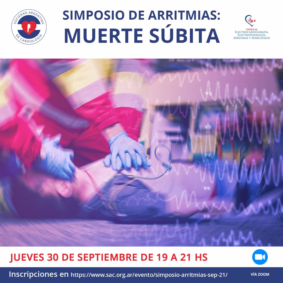 ArritmiasSAC's tweet photo. Te invitamos a participar de nuestro clásico Simposio de Arritmias en Consultorio. Este año el tema es la Muerte Súbita. Interesante programa con excelentes expositores. 30/9 a las 19 hs 🇦🇷. Link: https://t.co/5mwfWuAoHj @SAC_54 @SACJoven @CarinaHardy4 @edurontoFF https://t.co/Rjhp6b8rkZ