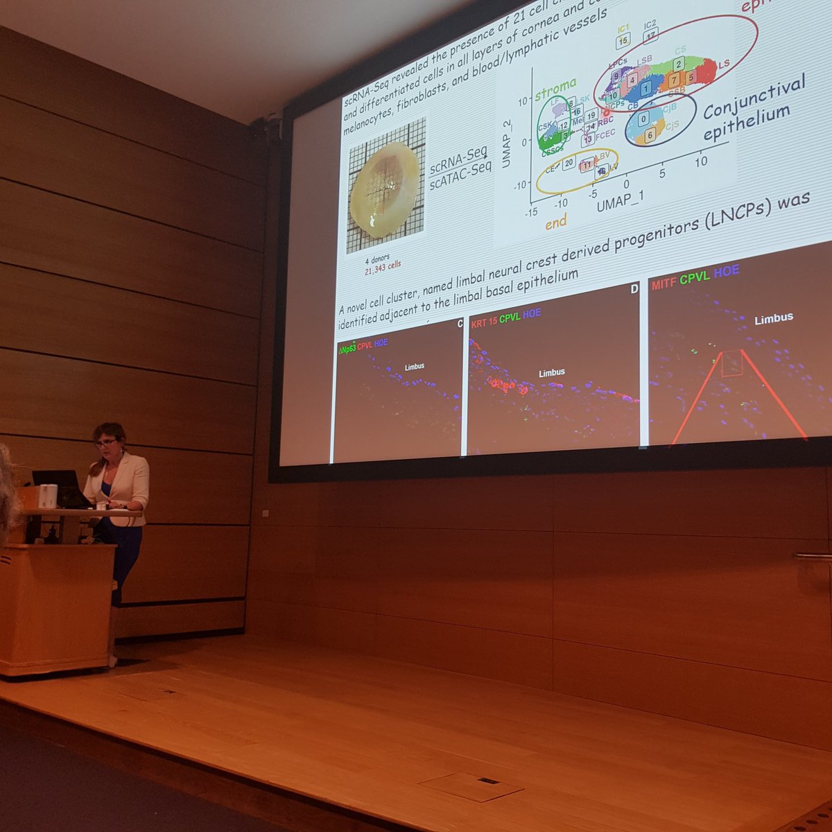 UKEyeGenetics's tweet image. Another brilliant talk at #UKEGG21 from @linda_lako in diving deeper into cell populations of the cornea using single cell #RNAsequencing to understand #gene differences between cells and using this knowledge to help patients