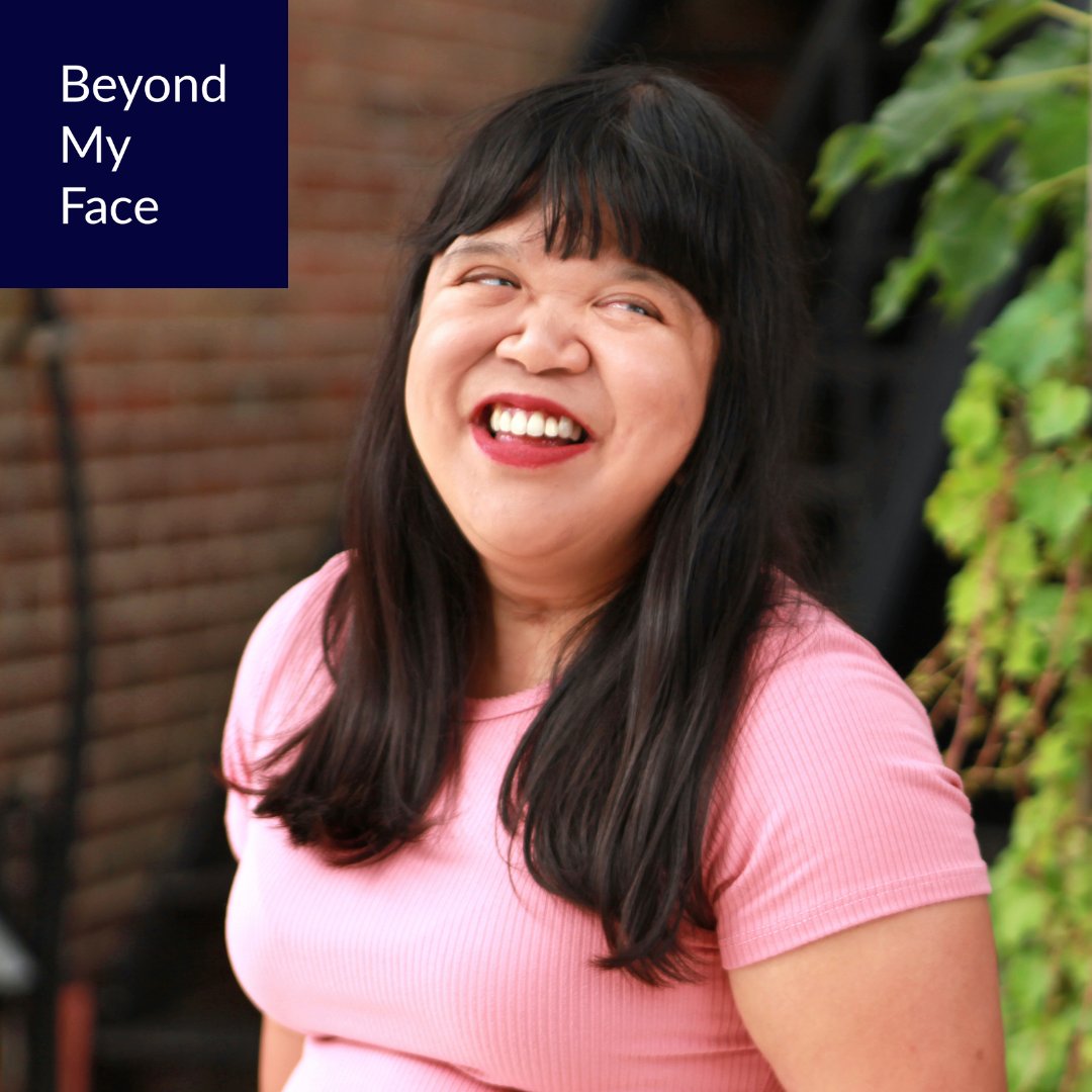 aboutface's tweet photo. “In order to foster a safe and inclusive space where individuals with facial differences feel accepted, empowered, and confident in themselves, we must strive towards educating others and increasing awareness of facial differences." - Christine
#BEYONDMYFACE
VIDEO COMING SOON! https://t.co/nfLnwQXNe9