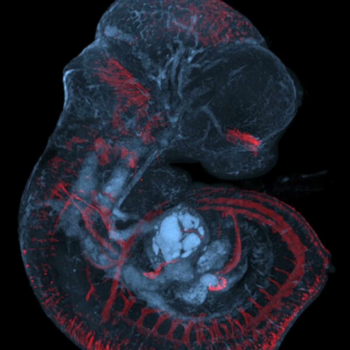 SRBR_Outreach's tweet photo. We all know that #light is vital to the wellbeing of our #circadian #clocks. But light might also be important to the developing foetus (https://t.co/zcSXxbHx2B) @UmeaUniversity @GunhagaS https://t.co/wVE6IXYWbp