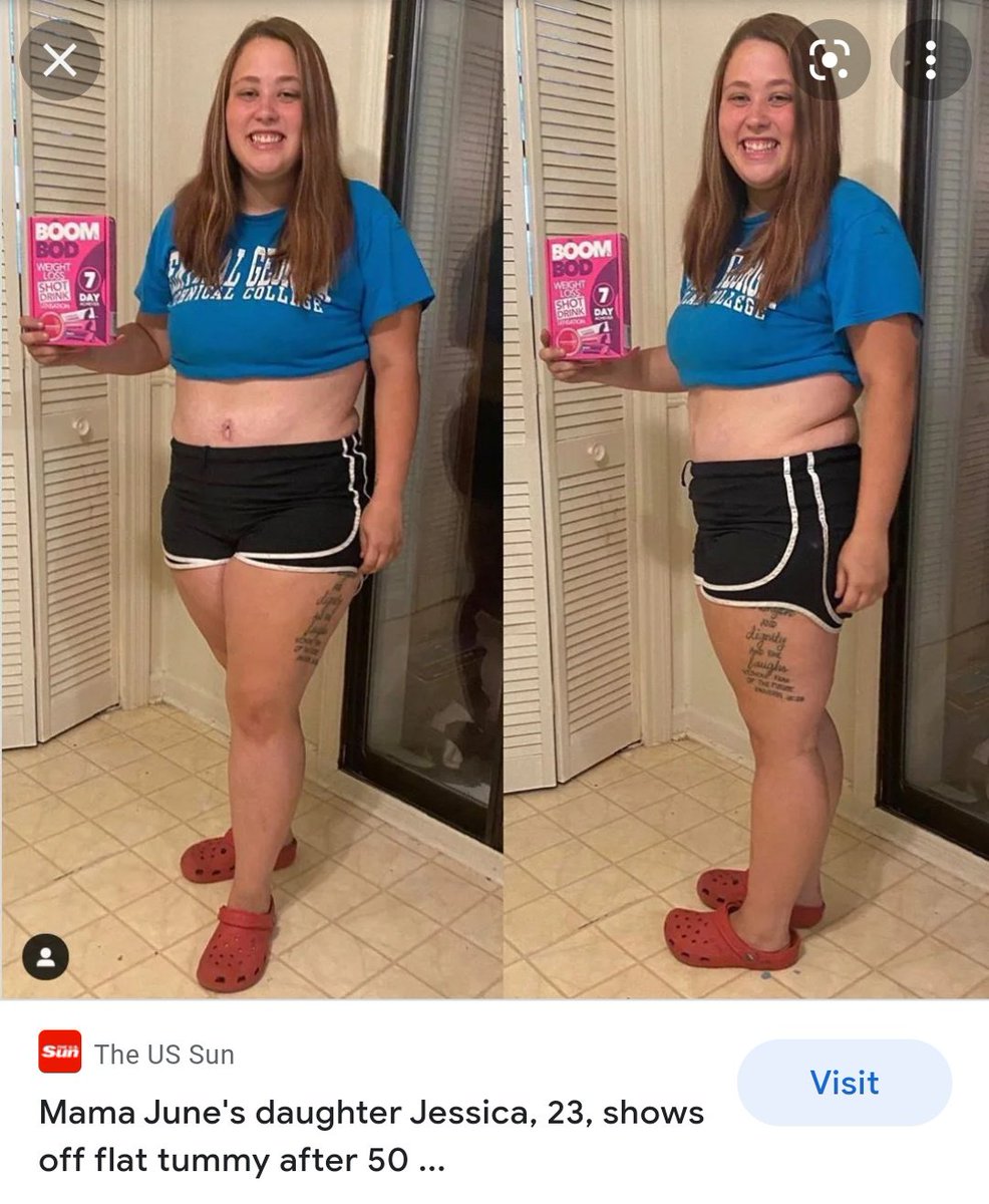 PerfectPinkx's tweet image. In what fucking world is her stomach "flat"