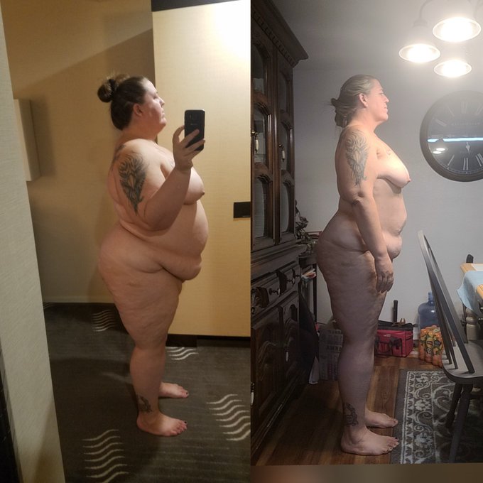 Once I get all this skin removed it will be like walking around with a completely different body from