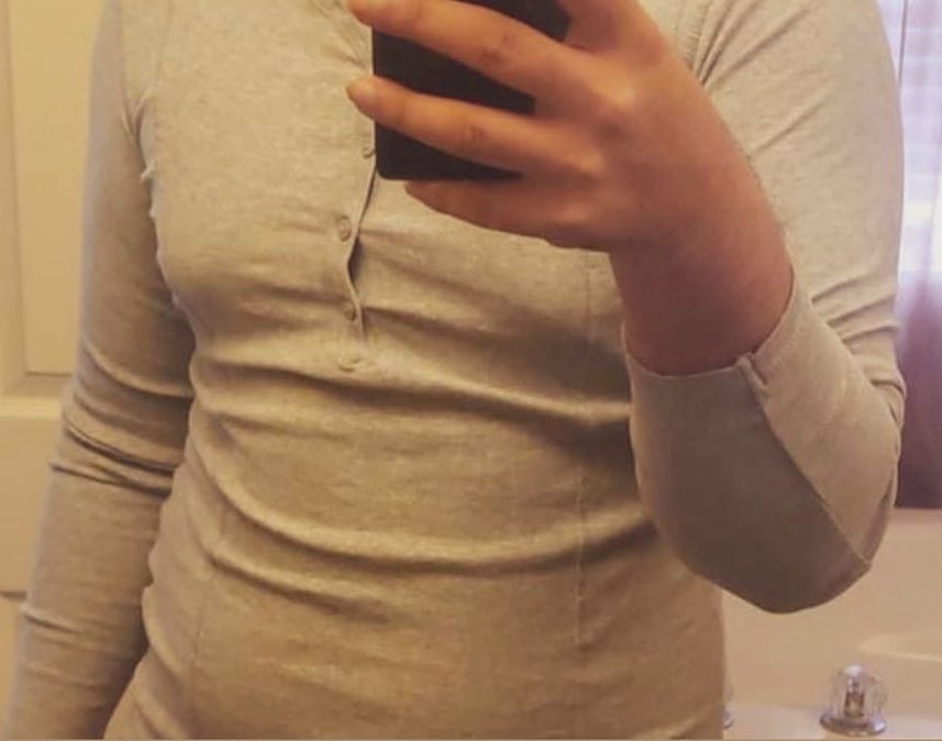 _SJPeace_'s tweet photo. Before and After 

Before pic was at 190 though not 215. Wish I took a picture when I was at 215.

I started the gym after losing the weight. https://t.co/KftvmWu9WY