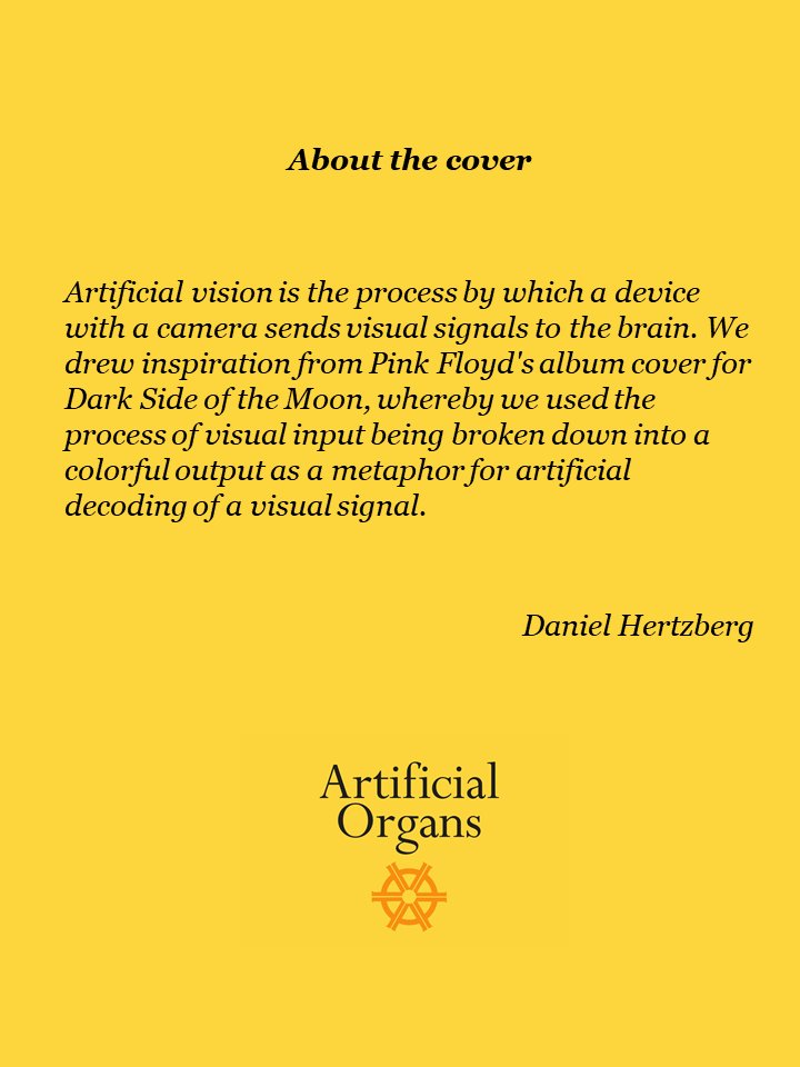 ArtifOrgans's tweet photo. #OnTheCover of October issue: The application of #ComputerVision to #VisualProsthesis 👇
https://t.co/h2ngkZiD2E
#ArtificialVision #MachineVision @pinkfloyd #TheDarkSideOfTheMoon
@danielhertzberg https://t.co/JXjPF3Efkr