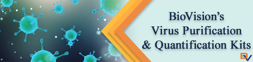 BioVision_Inc's tweet image. BioVision offers numerous Virus Purification Kits and Reagents for the fast and efficient purification of recombinant virus from transfected cell culture supernatants, or  infected samples. #biotech #biology #microbiology #research #molecularbiology hubs.ly/H0XRfM40