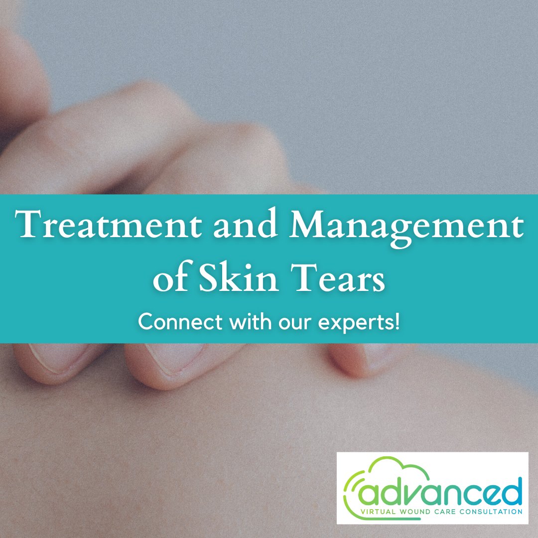advwoundcare's tweet photo. Identified as traumatic wounds on vulnerable skin, older adults or newborns are susceptible to skin tears that may result in prolonged hospitalization. 

Get in touch to know more about skin tears treatment from experts at Advanced Wound Care.

#skintears #woundcare #woundexperts https://t.co/0DsQmHviDM
