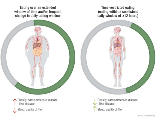 Is it how much you eat, when you eat, or just what you eat that matters? #weightloss #obesity #diabetes #T1D #T2D #CVD #inflammation  A new review from <a href="/SatchinPanda/">Satchin Panda</a> <a href="/salkinstitute/">Salk Institute</a> #EndocrineReviews <a href="/EndoSocJournals/">Endocrine Society Journals</a>  Time Restricted Feeding academic.oup.com/edrv/advance-a…