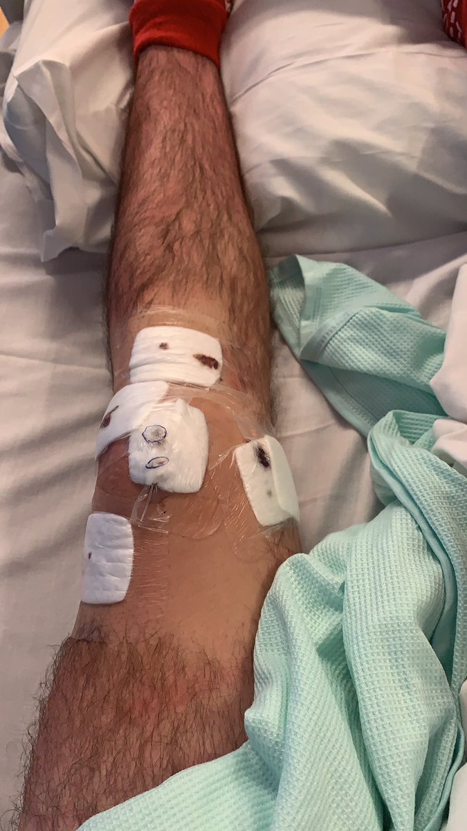 Jack | Redline tweet media