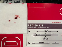 PenNeuro's tweet image. US HCPs: Glad Dr. Avinash Mesipam was able to experience #RED68! #REDglideDifference #RaisingTheStandard Rx only. For indications, contraindications, warnings, precautions &amp;amp; potential adverse events see bit.ly/2BYj7Yj Clinical results may vary.