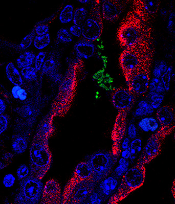 The Hunstad lab <a href="/WUSTLmed/">Test Account</a> and @WUPedsID is seeking a postdoctoral fellow in Gram-negative bacterial pathogenesis to start work ASAP on NIH-funded projects!  Check out the lab at hunstadlab.wustl.edu and apply here: bit.ly/3AN11St