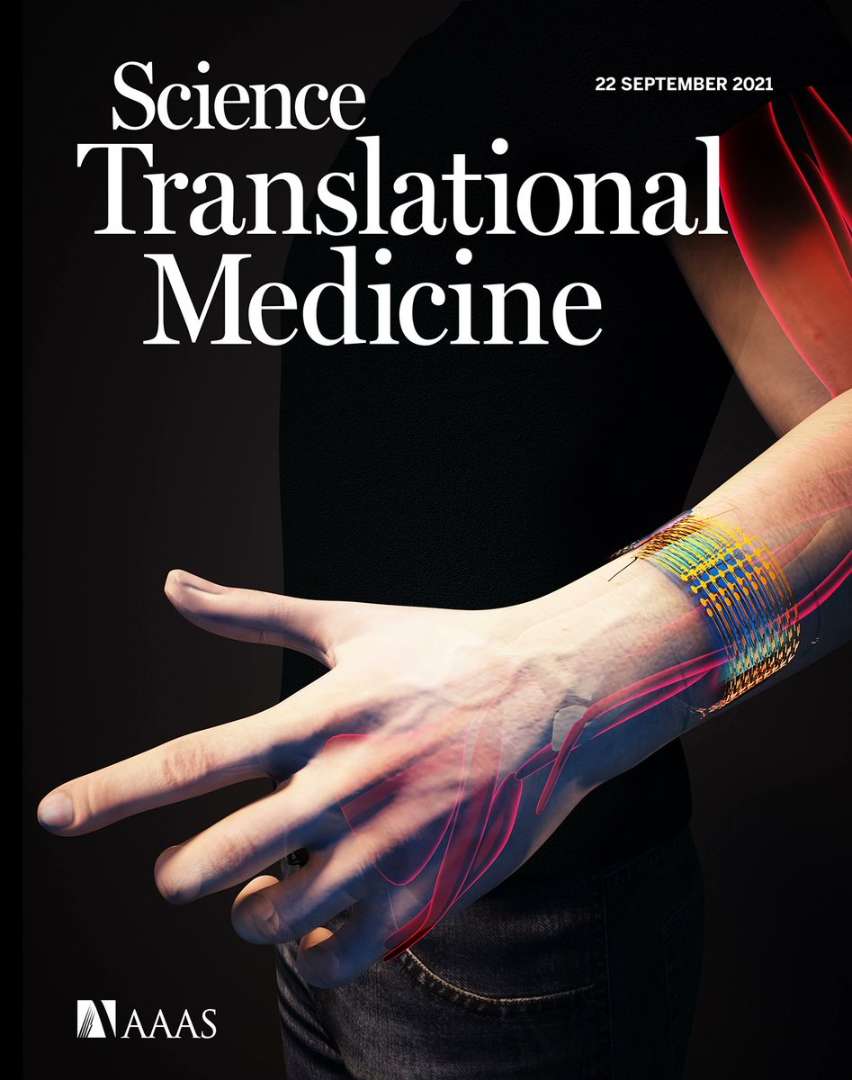 Nicki Driscoll (@nicki_driscoll) on Twitter photo Many thanks to the incredible team of collaborators who made this work possible: Flavia Vitale, <a href="/gogotsi1/">Yury Gogotsi</a> <a href="/johndmedaglia/">John Medaglia</a> <a href="/DrewNeuro/">Drew Richardson</a> @SGullbrand @katedavis12341 and others not on Twitter! Also to <a href="/Ella_Maru/">Ella Marushchenko</a> for the beautiful cover art! <a href="/pennbioeng/">Penn Bioengineering</a> <a href="/PennNeurology/">University of Pennsylvania Neurology</a> <a href="/DrexelMaterials/">Drexel Materials</a> Many thanks to the incredible team of collaborators who made this work possible: Flavia Vitale, <a href="/gogotsi1/">Yury Gogotsi</a> <a href="/johndmedaglia/">John Medaglia</a> <a href="/DrewNeuro/">Drew Richardson</a> @SGullbrand @katedavis12341 and others not on Twitter! Also to <a href="/Ella_Maru/">Ella Marushchenko</a> for the beautiful cover art! <a href="/pennbioeng/">Penn Bioengineering</a> <a href="/PennNeurology/">University of Pennsylvania Neurology</a> <a href="/DrexelMaterials/">Drexel Materials</a>