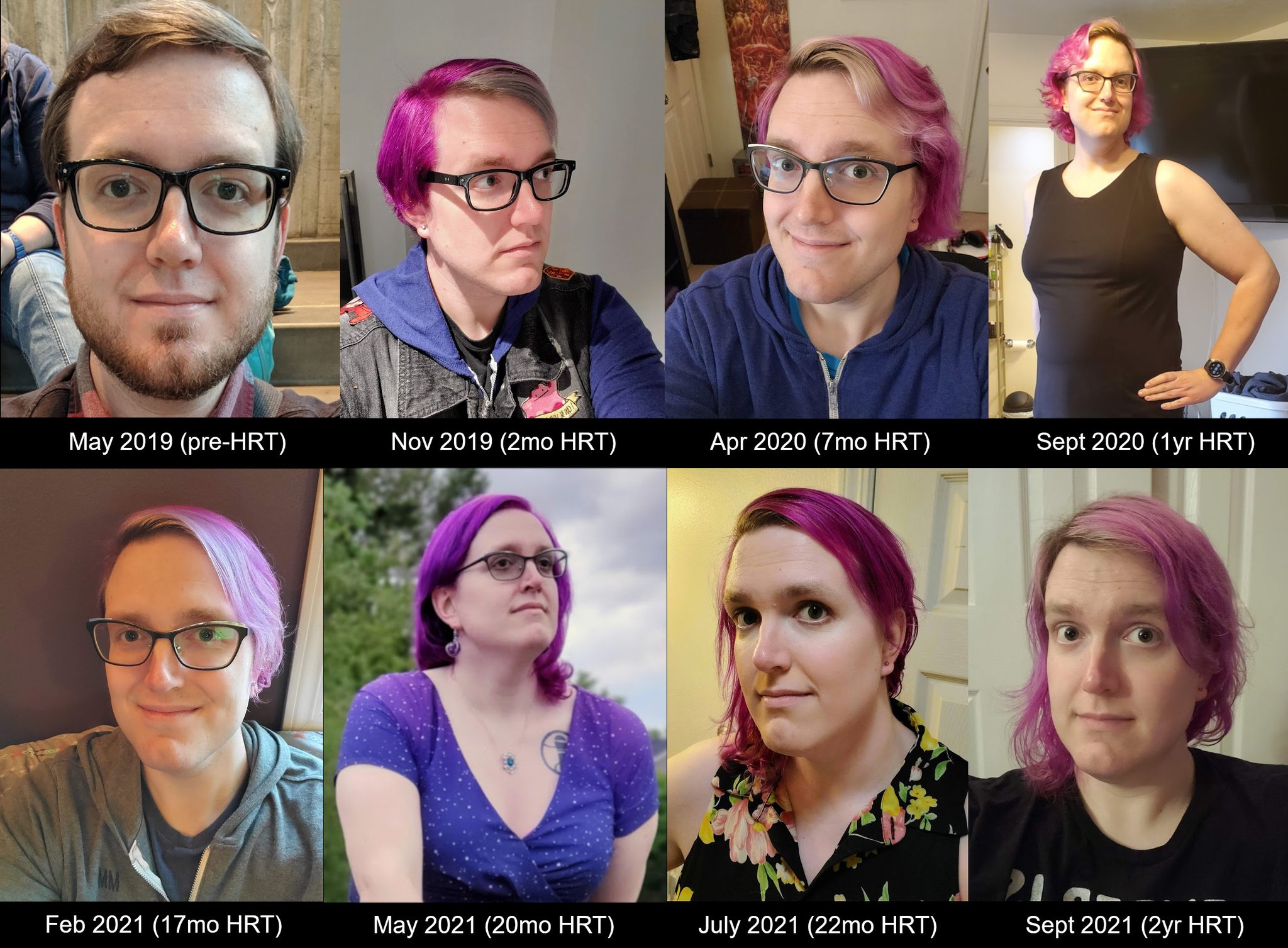 Andy Sage on X: Yesterday was my 2-year HRTiversary! (HRT stands for  hormone replacement therapy, the medication process used by some  transgender people to make their bodies better match their gender.) To