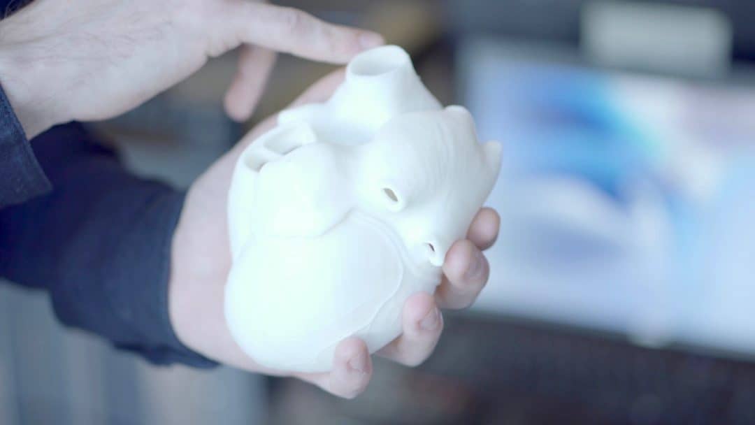 3dheals's tweet image. Even after a #CPTcode is established, it does not mean the procedure will be reimbursed with an adequate amount of payment. bit.ly/3xJUANK #ExpertCorner #medical3dprinting #bioprinting #3DTech
