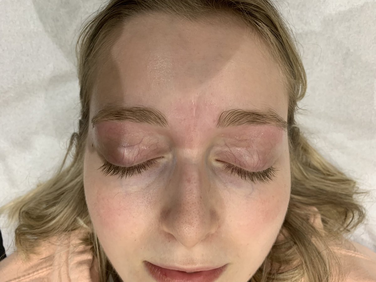 BluebellMandB's tweet photo. Fresh eyebrows ready for moving to uni! 💁🏻‍♀️

➡️ before

Message me to book - all appointments work around my day job.

#beauty #beautician #eyebrows #browwax #browshape #Shepshed #Leicestershire https://t.co/svQYiylRGJ