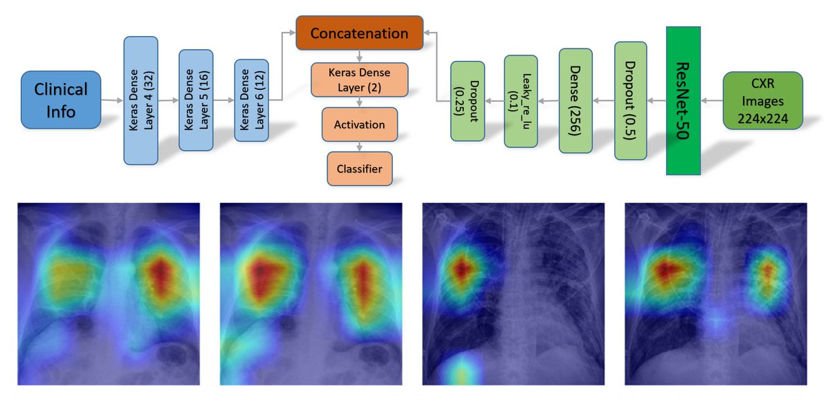 Our Paper "AIforCOVID: Predicting the clinical outcomes in patients with COVID-19 applying AI to chest-X-rays. An Italian multicentre study" published in "Medical Image Analysis" is now publically accessible. A Special thanks to all the collaborators doi.org/10.1016/j.medi…