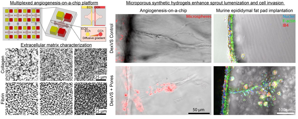 Baker Lab (@bakerlaboratory) on Twitter photo Check out our new paper in <a href="/ActaBio/">Acta Biomaterialia</a>! We compared the angiogenic potential of natural and synthetic hydrogels and found porosity to be a critical regulator. We then designed an approach to imbue microporosity in synthetic hydrogels to enhance angiogenesis.
authors.elsevier.com/a/1dkGC6CFjZIb… Check out our new paper in <a href="/ActaBio/">Acta Biomaterialia</a>! We compared the angiogenic potential of natural and synthetic hydrogels and found porosity to be a critical regulator. We then designed an approach to imbue microporosity in synthetic hydrogels to enhance angiogenesis.
authors.elsevier.com/a/1dkGC6CFjZIb…