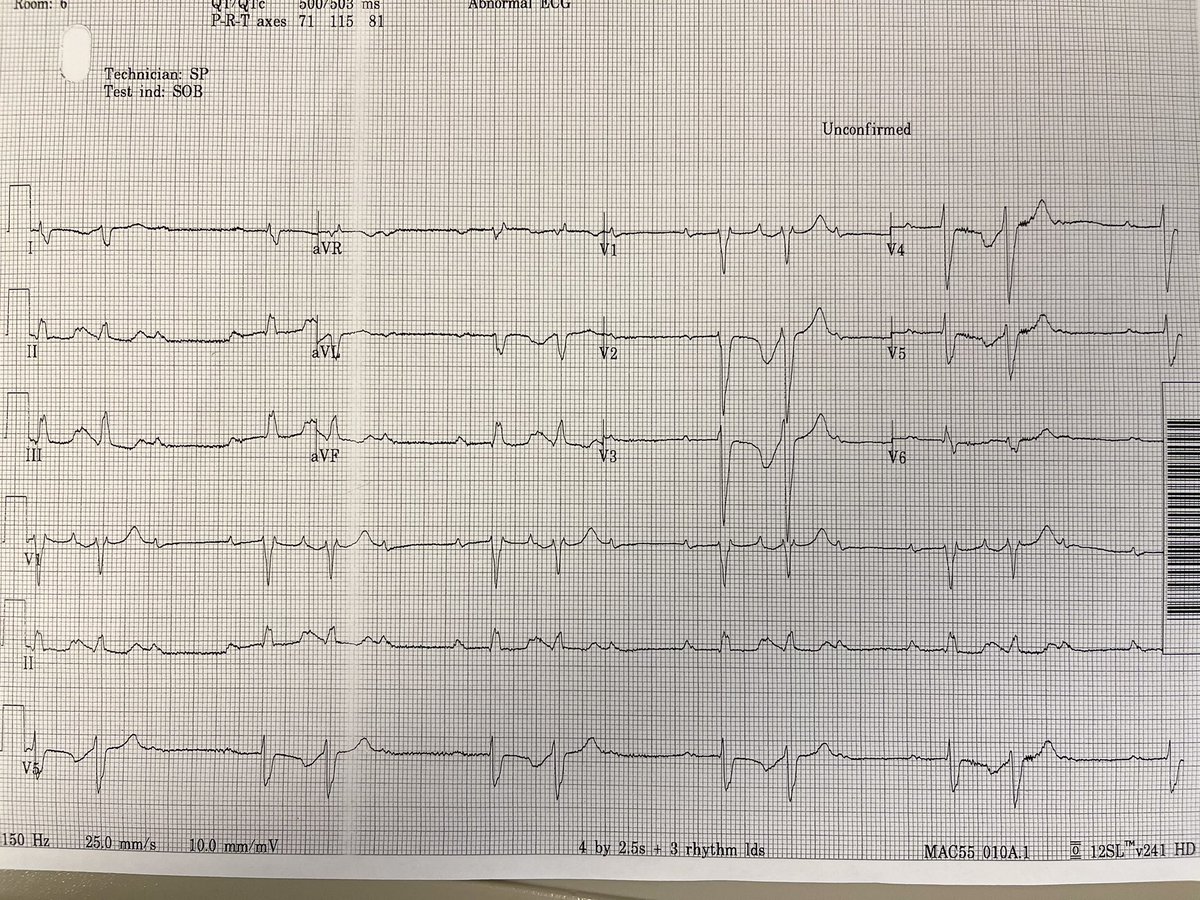 What’s happening ?
Fellows #epeeps