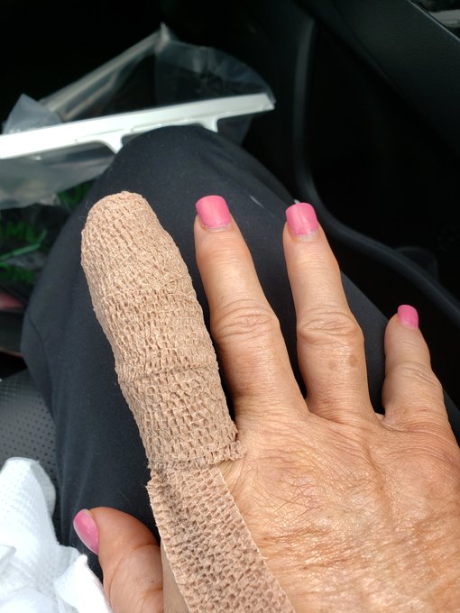 My finger got fixed. My #feet need a massage! https://t.co/4sIEt4dlyf https://t.co/l9bk5ixkxv<a href="/tag/feet"class="tags">#feet</a>