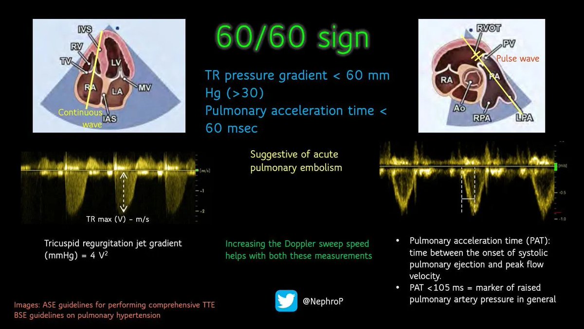 NephroPOCUS tweet media