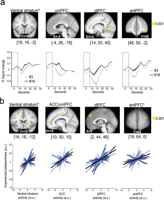 This is an image of a brain being manipulated by price cues about a wine.  The brain's valuation and affective regulation system link price cues to experienced taste pleasantness. If I tell you a headphone costs 6x more than it does it may sound better.

pubmed.ncbi.nlm.nih.gov/28808246/