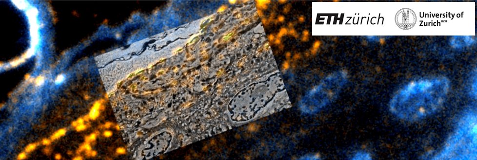 UZH Microscopy (@uzh_microscopy) on Twitter photo We are very happy to announce that the <a href="/UZH_en/">University of Zurich</a> <a href="/ETH_en/">ETH Zurich</a> <a href="/ETH/">ETH Zürich</a> Advanced Microscopy #WinterSchool course will be held 17- 21 January 2022! Practical modules on Light and Electron #Microscopy techniques. For more details check zmb.uzh.ch/en/teaching/Wi… We are very happy to announce that the <a href="/UZH_en/">University of Zurich</a> <a href="/ETH_en/">ETH Zurich</a> <a href="/ETH/">ETH Zürich</a> Advanced Microscopy #WinterSchool course will be held 17- 21 January 2022! Practical modules on Light and Electron #Microscopy techniques. For more details check zmb.uzh.ch/en/teaching/Wi…