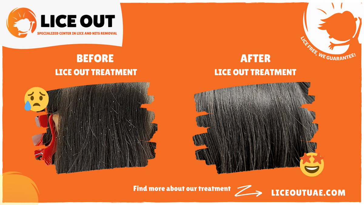 Lice Out (lice_out) Twitter