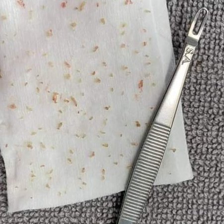 GPBSinGle's tweet image. 🛒ไปช็อปออนไลน์ตัวนี้มา.. ต้องรีวิวล่ะอ่ะ เอาไหนมาไม่ปังงง สภาพ ปังขั้นสุด🧚 รีวิวสั้นๆ สิวหัวเปิดออกเกลี้ยง อันไหนหัวปิด เข็มจิ้มเอา แล้วกด กด กด 😘 มันจึ้ง มันปัง ..ขอยืมคำ พส.😁 ไม่รีวิวไม่ได้ กดไม่ทิ้งรอย เต็ม10ไม่หัก #ใช้ดีบอกต่อ #ไว้รีวิวห้ามขายของโว้ยยย #HowtoPerfect