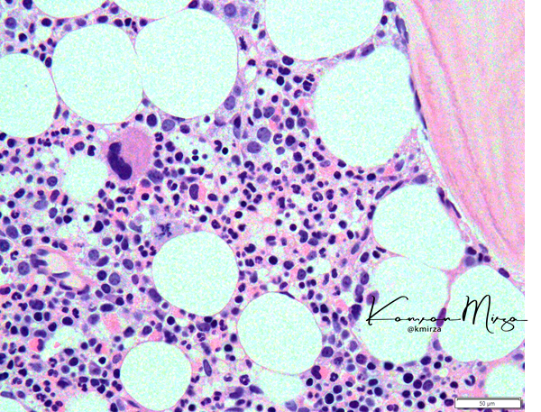 The #BoneMarrow is a miracle

That's it, that's the tweet.

#leusm #mmsm #lymsm #pathology #hemepath #path2path #medstudenttwitter #medtwitter