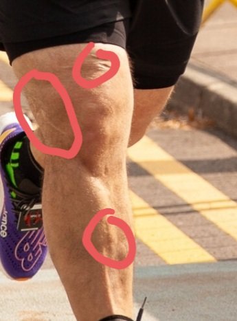 technolagnos's tweet image. Looking at my race photo earlier, I realised that it&apos;s one of the few photos that show some of my scars. 30 years ago I had a motorcycle accident. Doctors said I&apos;d never walk without a limb, never mind run. I count my blessings every day for being able to run, no matter how slow.