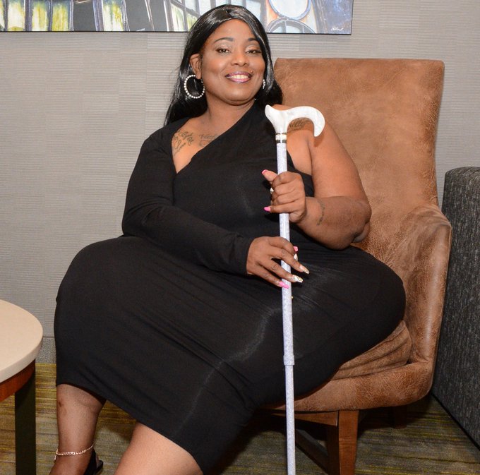 Keep your face toward the sunshine and shadows will fall behind you #Disability #disabled #model #bbwpear<a href="/tag/model"class="tags"><span>#model</span></a><a href="/tag/beautiful"class="tags"><span>#beautiful</span></a><a href="/tag/sexy"class="tags"><span>#sexy</span></a><a href="/tag/proud"class="tags"><span>#proud</span></a><a href="/tag/bbwpear"class="tags"><span>#bbwpear</span></a><a href="/tag/disability"class="tags"><span>#disability</span></a>