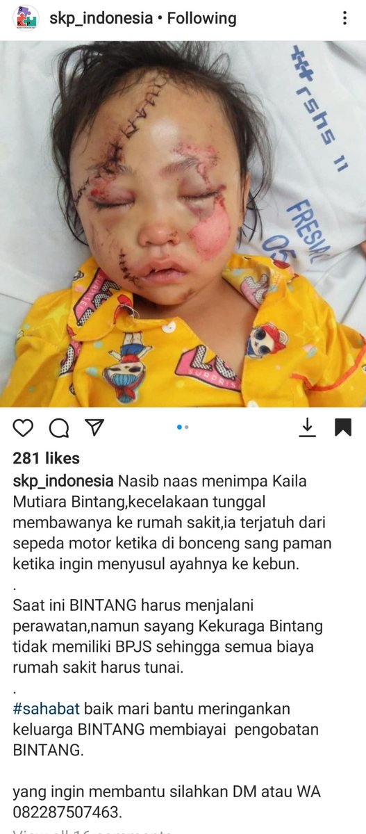 Ndons_Back's tweet photo. Berikan donasi terbaik kalian 

Tubuh Kayla Terpental, Batok Kepalanya Alami retak
https://t.co/rxWTLWB5ek https://t.co/jcTLXWT6R5