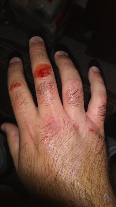 Fucking step father driven me to punch fucking walls. Sick of this fucking monster treating me like scum<a href="/tag/hypersexual"class="tags"><span>#hypersexual</span></a>