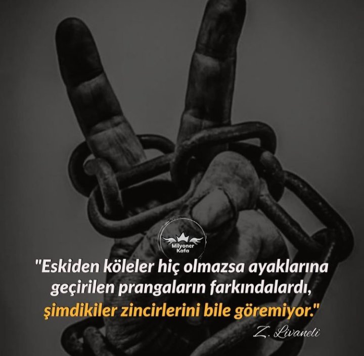 Bəs siz ayağınızdakı zinciri görəbilirsinizmi?