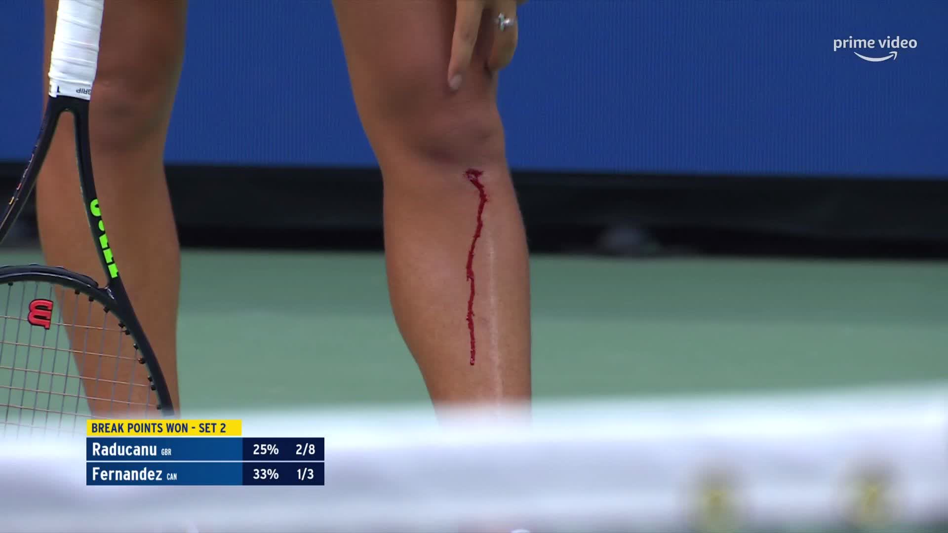 Amazon Prime Video Sport on Twitter "Emma Raducanu is putting her body