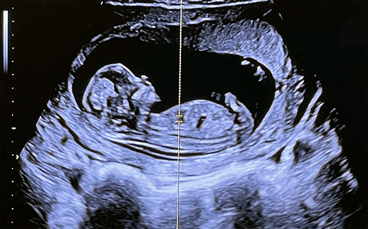 Creo que ya va siendo hora de anunciarlo:
📢 ¡¡Mi chica y yo estamos instalando un DLC!! 📢

Sí... Voy a ser padre... PADRE!! 🤯