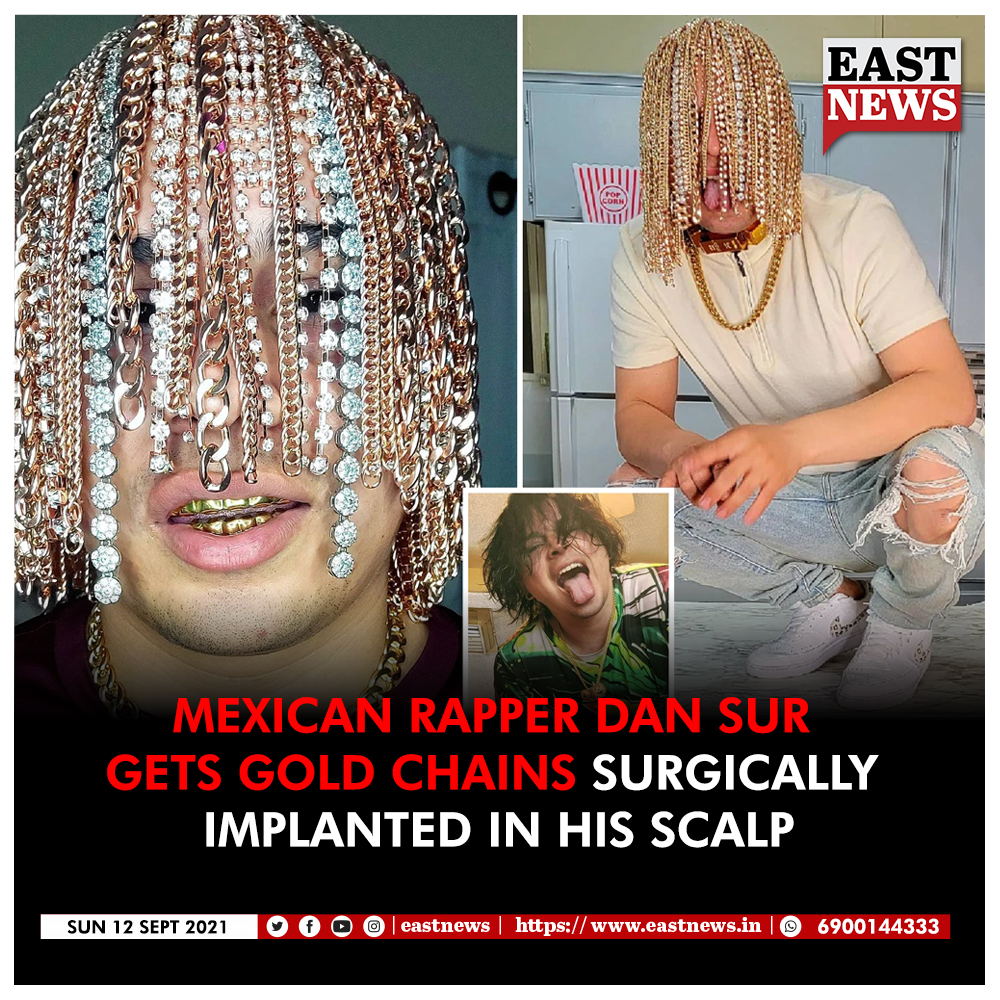 Mexican rapper Dan Sur gets gold chain surgically implanted into scalp  netizens surprised