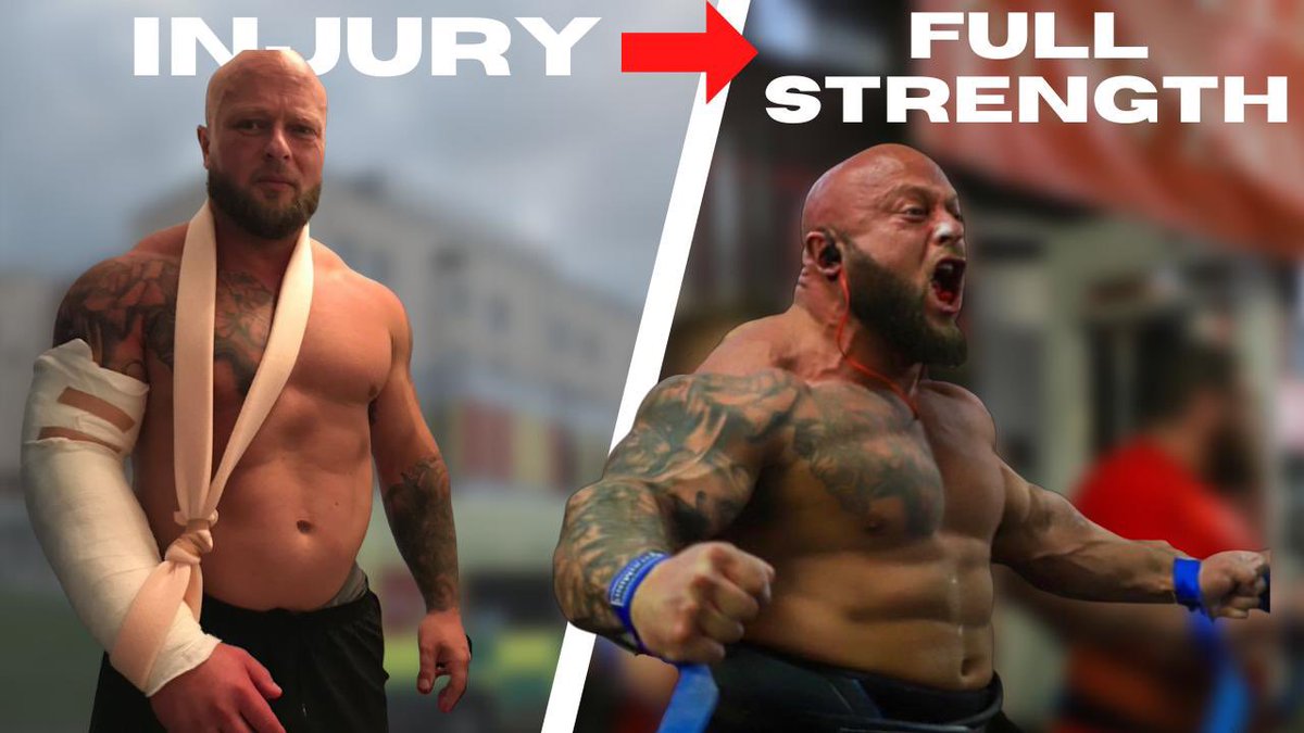 LukeFullbrook's tweet image. Tricep Detachment ! Strongman Competition Ending Injury ? youtu.be/vhD_V92i31U via @YouTube