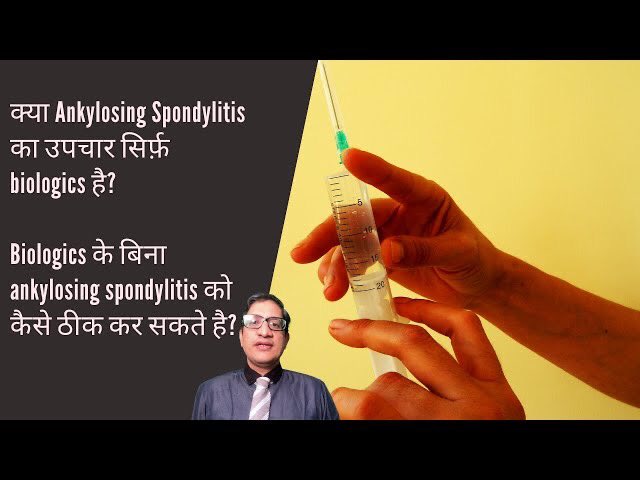 doctorakerkar's tweet image. क्या Ankylosing Spondylitis  का उपचार सिर्फ़ biologics है? Biologics के बिना AS कैसे ठीक कर सकते है?
youtu.be/9DlEXsFDzuo
#ankylosingSpondylitis #AxSpa