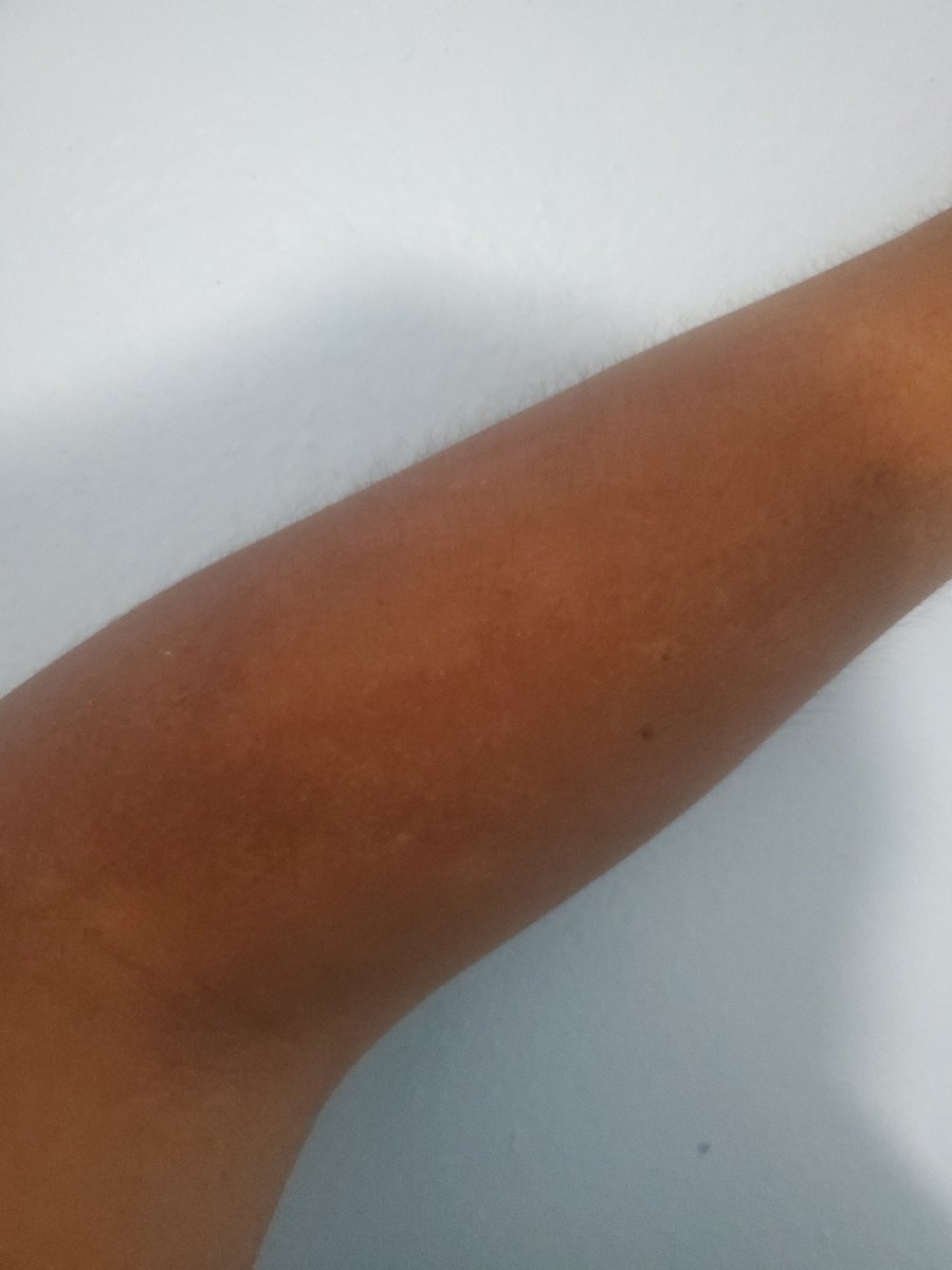 JoeIProductions's tweet image. NOOOO MY MARCHING BAND TAN IS GOING AWAYYY