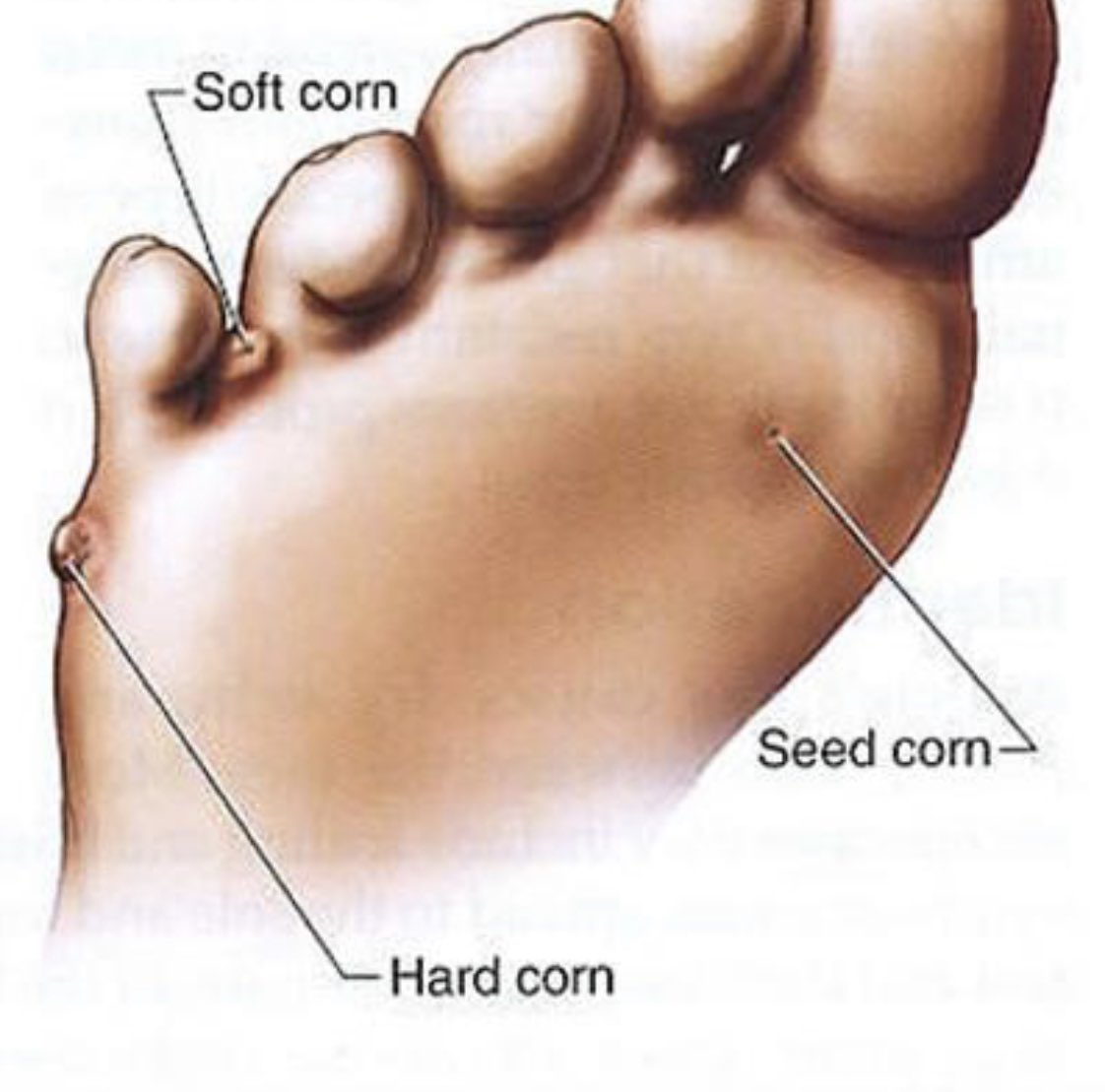 Toes рисунок. Сустав большого пальца ноги. Молоткообразные деформации стопы. Стопы девушек. Красивые ступни ног.