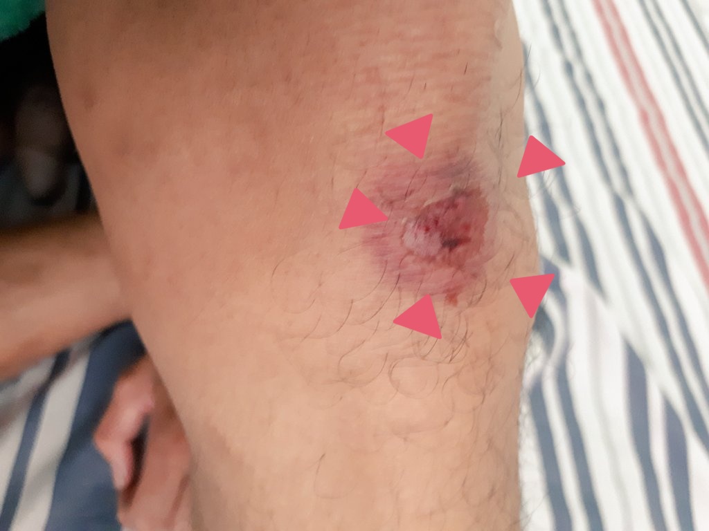 สะดุดล้ม..เจ็บบบบบบ 😢