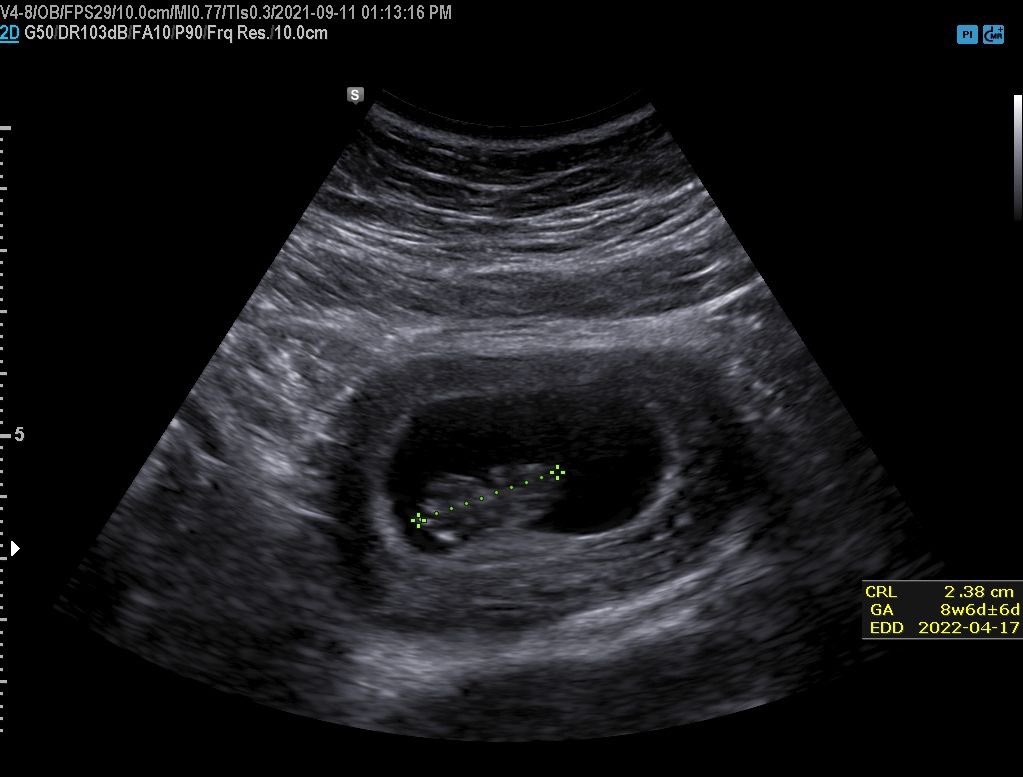 RllTZY's tweet photo. Ion put much of my life on this bih at all but my girl and I got a mini me on the way 🙏🏼 https://t.co/rbT6dUWN2d