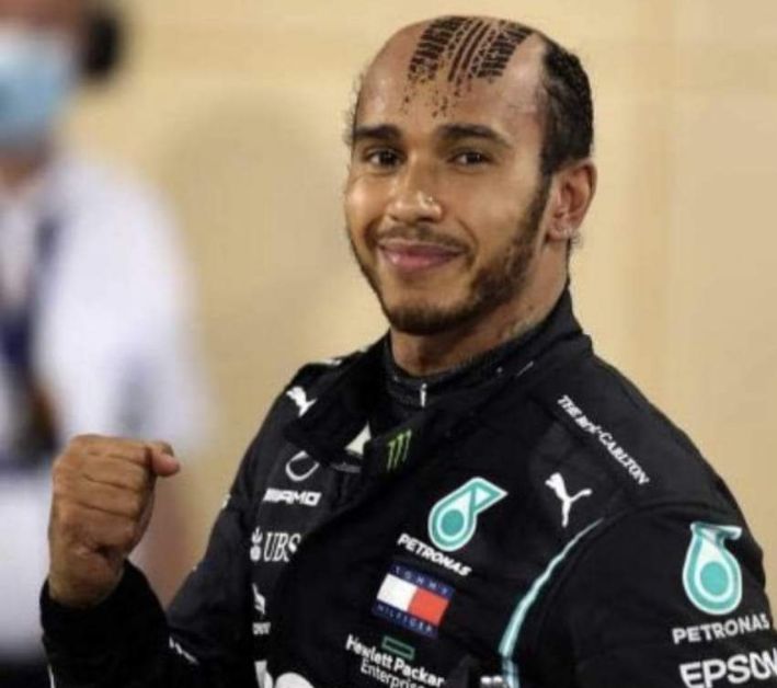 Pilas el Karma así te debió quedar la cabeza hoy