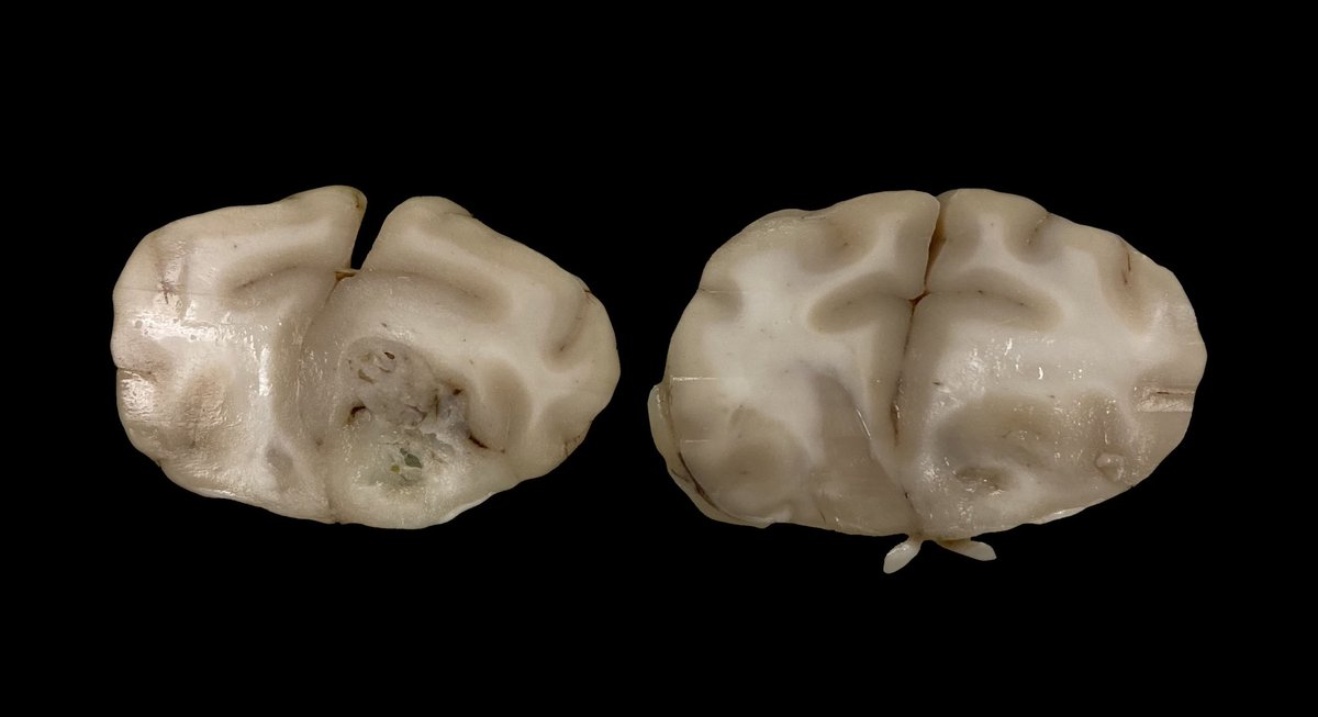 APowersPatho's tweet image. Day 10 of #vetpathology. Tissue from a cat: this section of brain is just rostral to the lateral ventricles in a neurologic, 12 year old cat. #twitterpathology #grosspathology