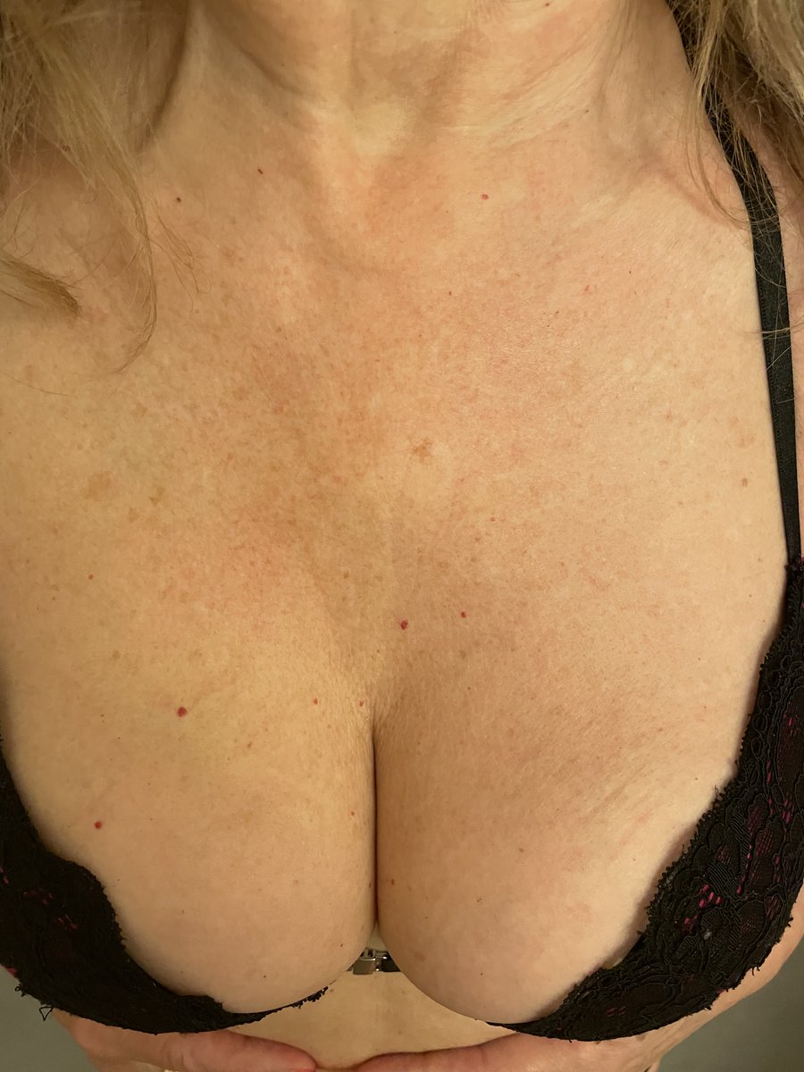 goddessnoonie's tweet photo. Breast Monday
#cougar #gilf #60plus #cleavage #paintednails 
#frontfastening #redunderwear 
Pics &amp; Vids Sold Via kik Goddessnoonie https://t.co/GnV26nPPHz