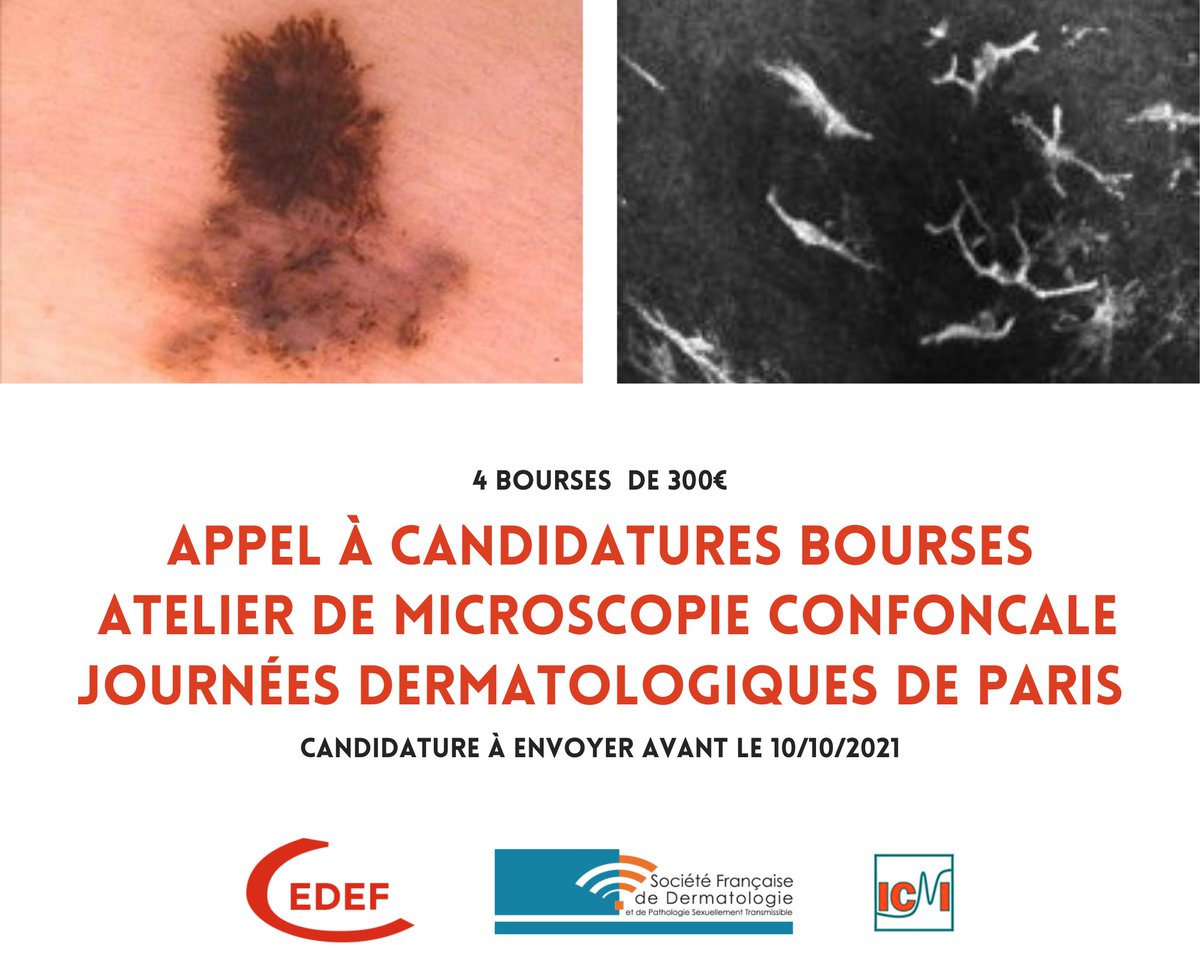 Appel à candidatures ! Bourses pour participer à l'atelier de microscopie confocale au Journées Dermatologiques de Paris 2021.
4 bourses de 300€ par le groupe groupe Imagerie Cutanée Non Invasive (ICNI) <a href="/SFDermatologie/">Société Française de Dermatologie</a> 
En savoir + : bit.ly/bourses-atelie…
